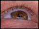 oeil_chapeau