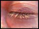 oeil_cils